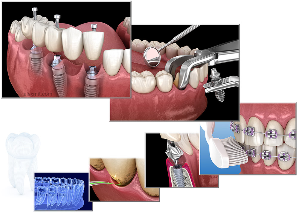 3D Dental illustrations