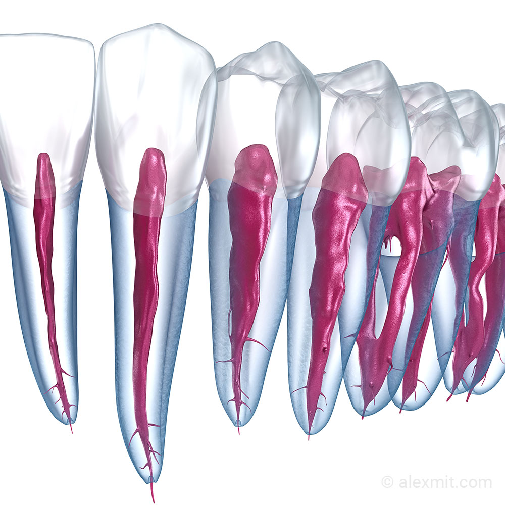 Root canals